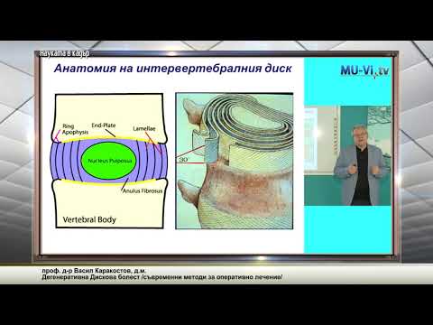 Дегенеративна Дискова болест /съвременни методи за оперативно лечение/