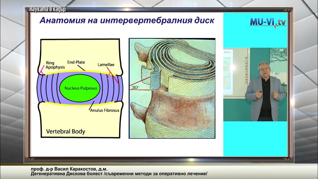 Дегенеративна Дискова болест /съвременни методи за оперативно лечение ...