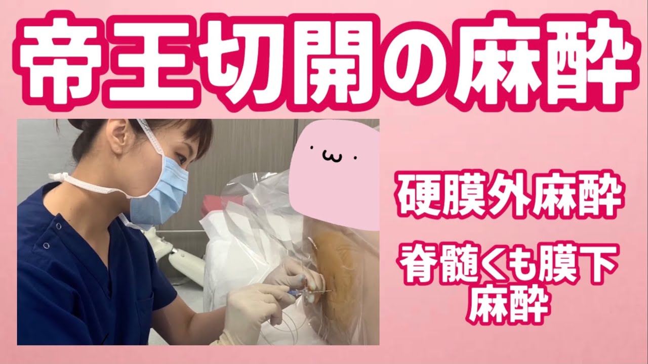 痛くない帝王切開の麻酔のポイント Youtube