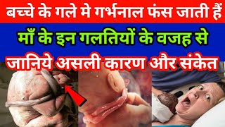 बच्चे के गले में गर्भनाल फस जाती है मां के इन गलतियों के कारण |Umbilical cord wrapped around neck|