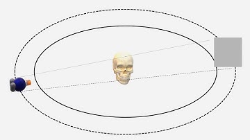 CBCT animation video