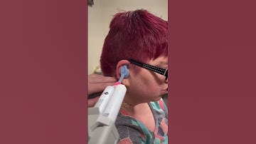 New custom fit hearing aids are on the way for this patient! #rochesterny #audiologist #asmr