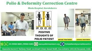 # Positive thoughts of polio patient #poliotreatment  #polio # bhola hospital