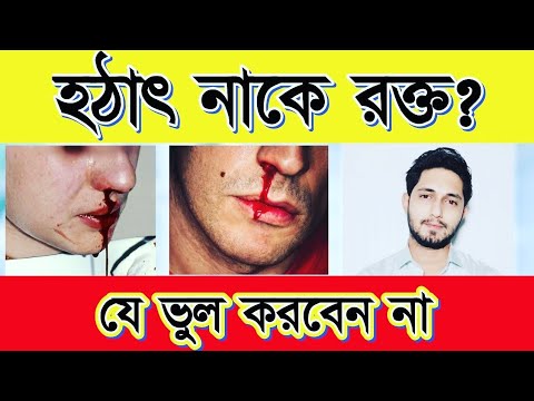 হঠাৎ নাক দিয়ে রক্ত পড়া বন্ধ করার ঘরোয়া উপায়।হঠাৎ নাক দিয়ে রক্ত পড়লে করনীয়।how to stop nasal Bleeding