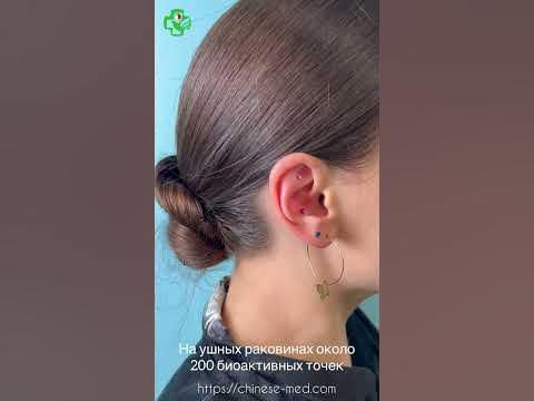 Аурикулотерапия, точки на ушах, китайская медицина #китайскаямедицина # ...