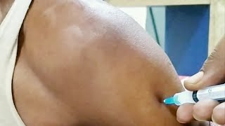 Intramuscular (IM) Injection Technique On Deltoid |  Easy way bangla Ep-11