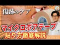 マイクロポアテープで傷跡ケアを完全解説！