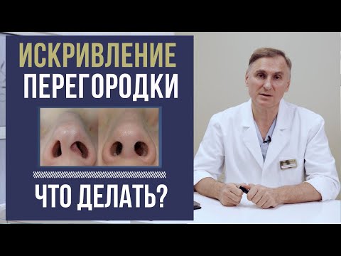 Искривление носовой перегородки как исправить в домашних условиях