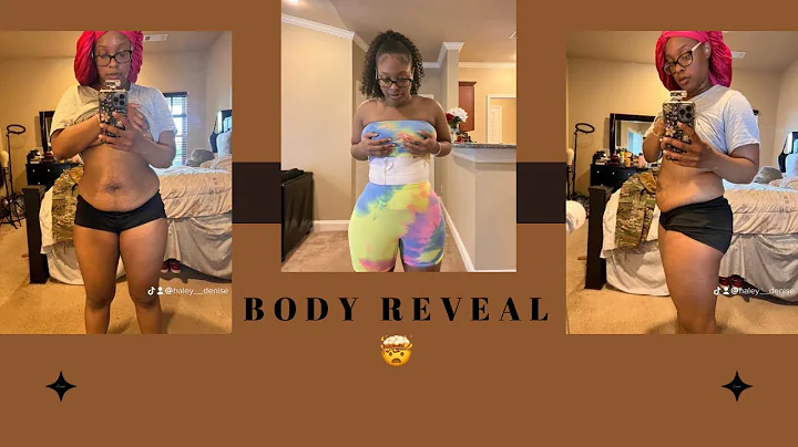 Tummy tuck vlog/Update : 3 week post op ! BODY REV...