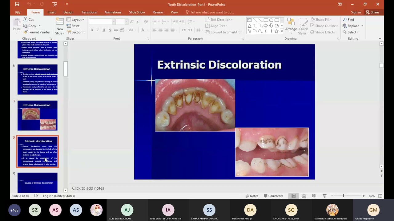 Lecture # 5  Tooth discoloration  Part I  Causes and etiology