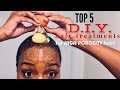 TOP 5 DIY Treatments for HIGH POROSITY to MOISTURIZE Dry Hair  | Nia Hope