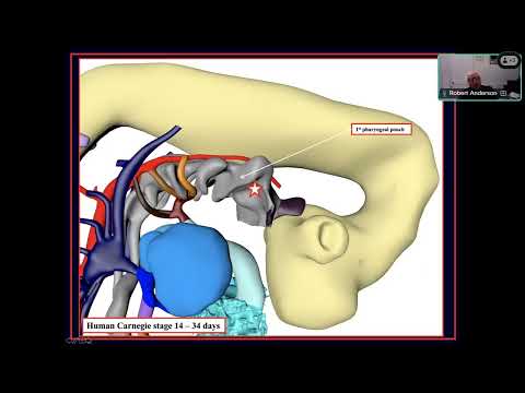 Aortic Arch Anomalies
