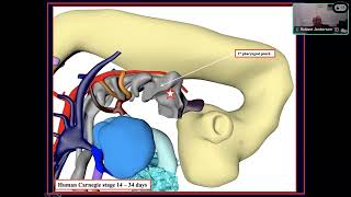 Aortic Arch Anomalies