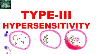 Type III Hypersensitivity | Immune complex mediated Hypersensitivity | Mechanism | Examples