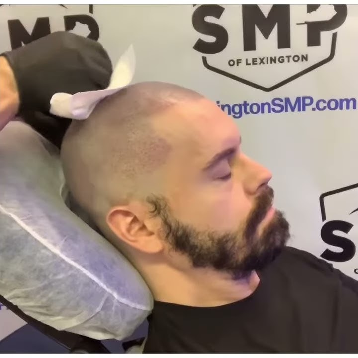 Scalp Micropigmentation Kentucky