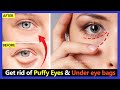 How to Get rid of Puffy Eyes and Under eye bags in 2 weeks. Facial Exercises & Lymphatic Eye Massage