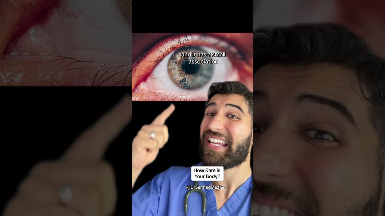 How Rare Is Your Body Special