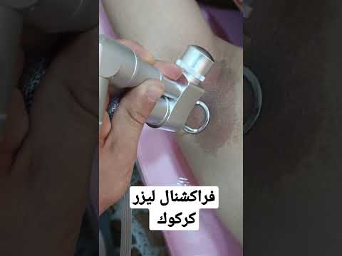 فراكشنال ليزر سعر الجلسة 50 الف كركوك