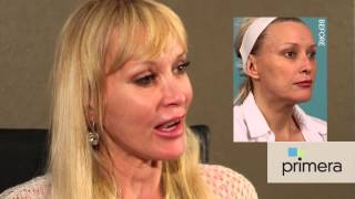 Rhinoplasty and Mini Lift Patient Shares Her Experience