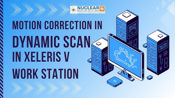 Motion correction in DTPA scan in Xeleris V Work Station