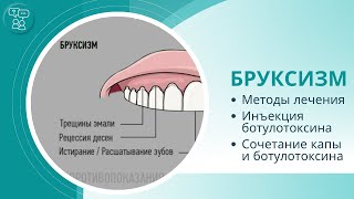 Бруксизм: методы лечения