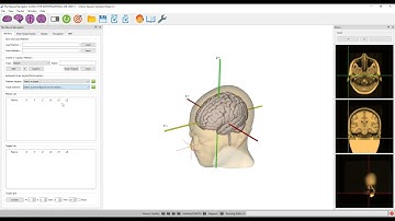 Soterix Medical Presents Neural Navigator: How to create project files for your patient