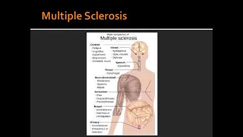 Spinal Cord Lesions - Poliomyelitis, Werdnig-Hoffman Disease & Multiple Sclerosis