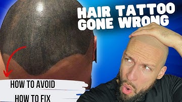 How To Remove BAD SMP | Scalp Micropigmentation Removal
