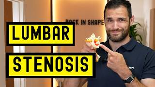 Exercises To Recover From Lumbar Spinal Stenosis At Home