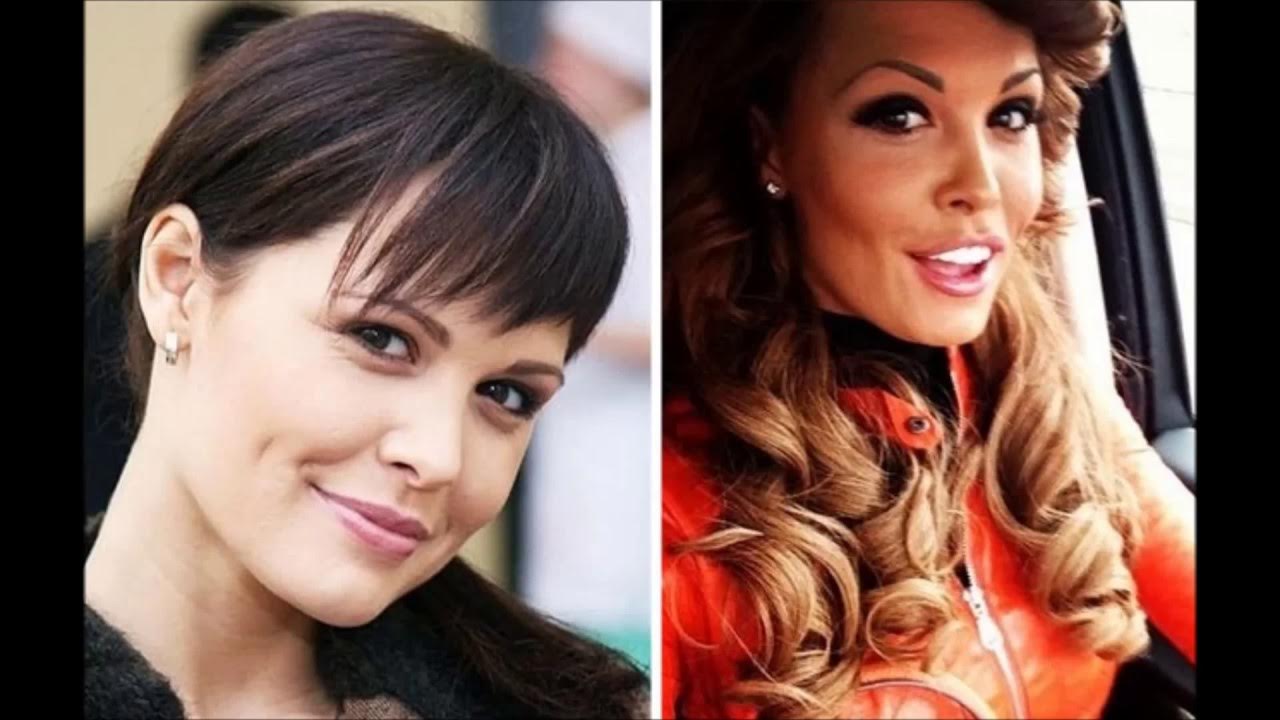 Мария Горбань до и после пластики фото, биография и все операции актрисы