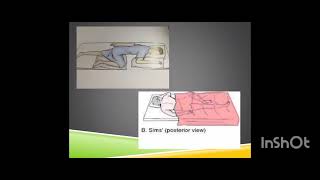 Type of patient Positions🏥⚕️⚕️and it's indications #nursing #shortsnote(nursing)