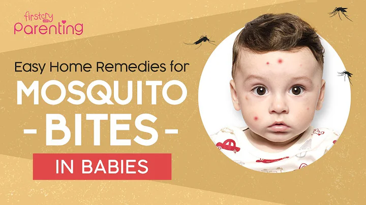 10 Easy Home Remedies for Mosquito Bites on Babies and Kids - DayDayNews
