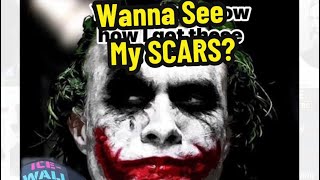 Wanna See My Scars?