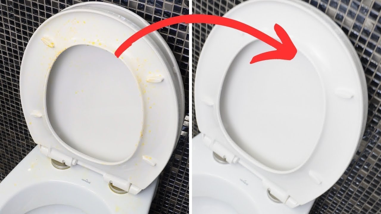 Wc Reiniger Flecken Auf Klobrille Entfernen Vergilbte Klobrille reinigen. Toilettenbrille wieder weiß bekommen