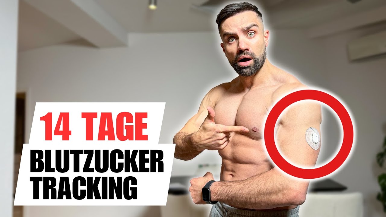 Das DING hat mein Leben verändert ! (CGM Test)