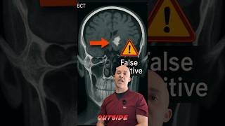 Why CBCT Isn’t Used for Routine Dental Screening  Caries, Periodontal Disease & Radiation Explained