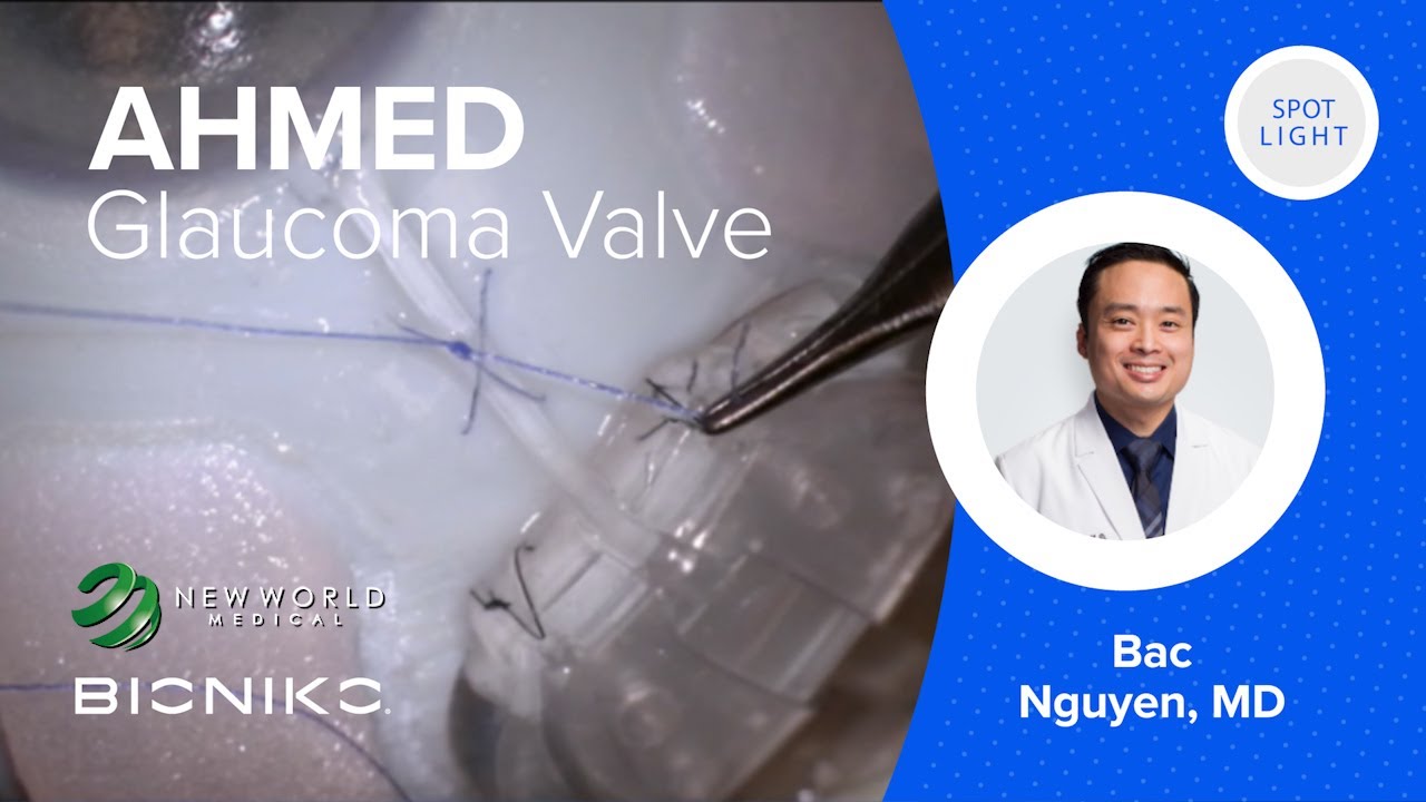 BIONIKO EX1 With AHMED GLAUCOMA VALVE AGV By BAC NGUYEN MD YouTube bioniko-ex1-with-ahmed-glaucoma-valve-agv-by-bac-nguyen-md-youtube