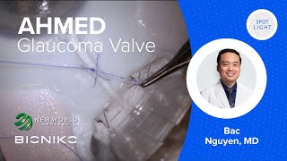 BIONIKO EX1 with AHMED GLAUCOMA VALVE (AGV) - by: BAC NGUYEN, MD