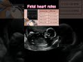 Baby fetal heart rate On ultrasound #shorts