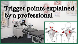What are trigger points: explained by a professional