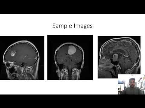 Brain Tumor Detection using Machine Learning Techniques - YouTube