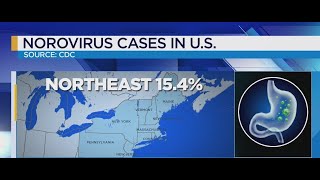 Stomach virus spreading across Northeast: CDC