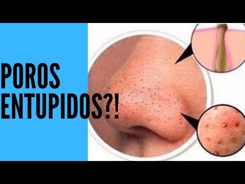 3 passos simples para desobstruir os poros entupidos – Faça você mesma