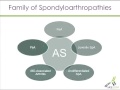 Identification and Classification of Spondyloarthropathies