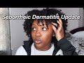 How I Manage Seborrheic Dermatitis with Type 4 Natural Hair | wash day routine, protective styles...