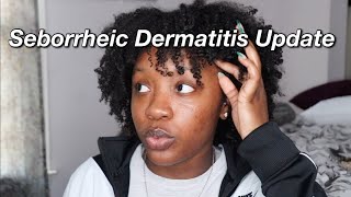 How I Manage Seborrheic Dermatitis with Type 4 Natural Hair | wash day routine, protective styles...