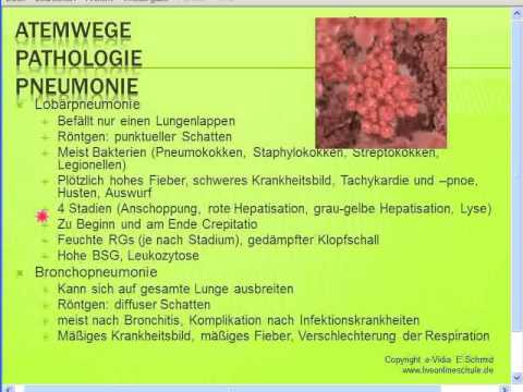 Gratis Seminar Pneumonien - Typische + atypische Pneumonien