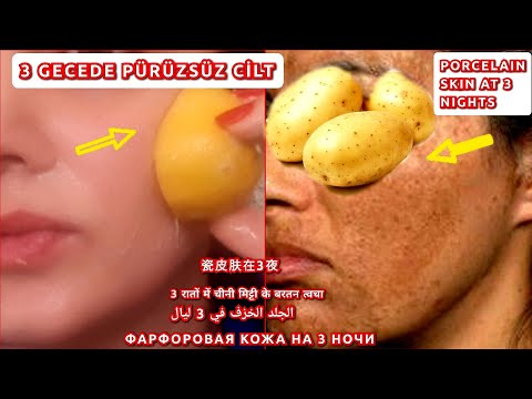 PATATES - LİMON MASKESİ İLE 3 GECEDE PORSELEN CİLT - CİLT BEYAZLATICI LEKE GİDERİCİ DOĞAL TARİF