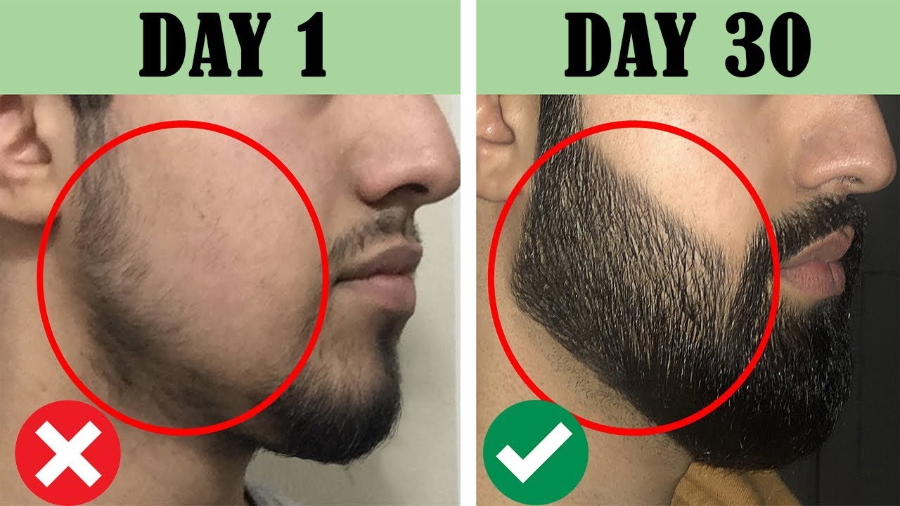 How To Grow Beard Naturally At Home Only 30 Days 100 Proved Youtube