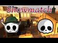 Torneo de huezitos y Paws: Torneo infinity- Showmatch #entretenimiento #left4dead2 #l4d2versus